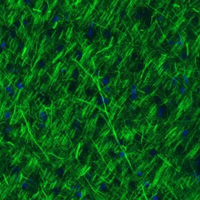 Immunohistochemistry: NF-M Antibody (CL2697) [NBP2-46619]