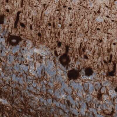 Immunohistochemistry: NF-M Antibody (CL2705) [NBP2-46625]