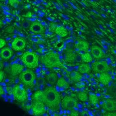 Immunohistochemistry: NF-M Antibody (CL2705) [NBP2-46625]