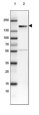 Western Blot: NF-M Antibody (CL2705) [NBP2-46625]