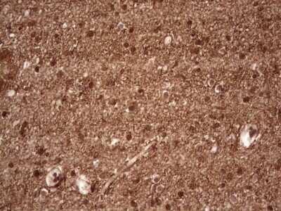 Immunohistochemistry: NF-M Antibody (OTI2G3) [NBP2-46139]