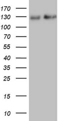 Western Blot: NF-M Antibody (OTI2G3) [NBP2-46139]
