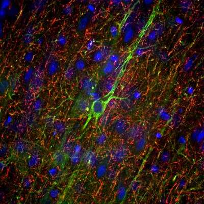 Immunohistochemistry Free-Floating: NF-M Antibody (3H11) [NB300-134]