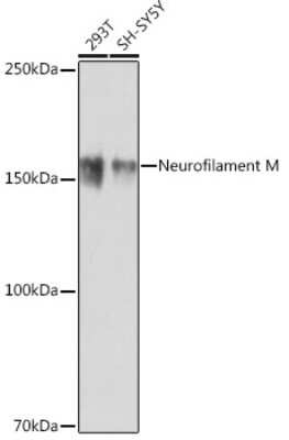 Western Blot: NF-M Antibody (5E0D2) [NBP3-15655]