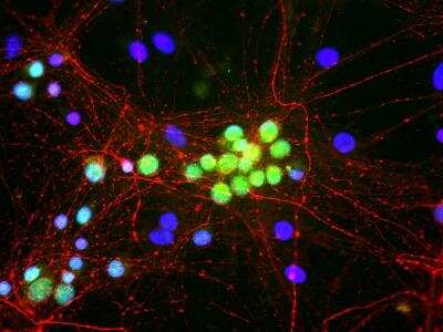 Immunocytochemistry/ Immunofluorescence: NF-M Antibody [NB300-133]