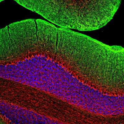 Immunocytochemistry/ Immunofluorescence: NF-M Antibody [NB300-133]