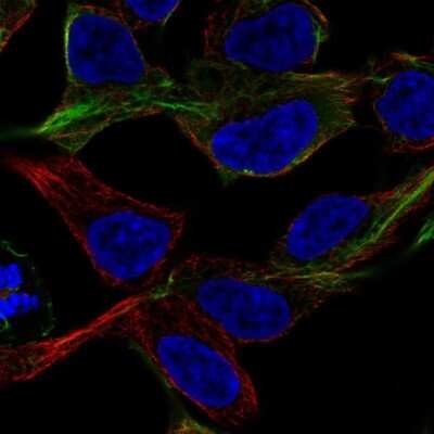 Immunocytochemistry/ Immunofluorescence: NF-M Antibody [NBP1-87754]