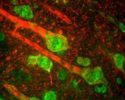 Immunohistochemistry-Frozen: NF-M Antibody [NB300-133]
