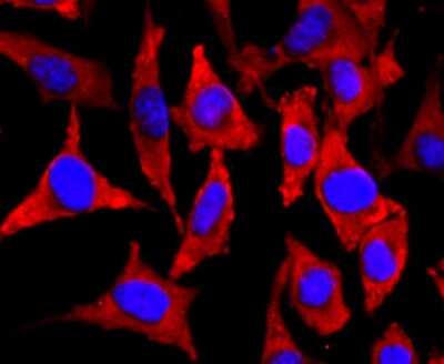 Immunocytochemistry/ Immunofluorescence: NF-M Antibody (JM11-20) [NBP2-66978]