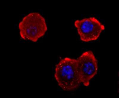 Immunocytochemistry/ Immunofluorescence: NF-M Antibody (JM11-20) [NBP2-66978]