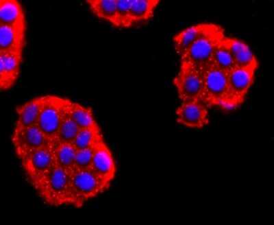 Immunocytochemistry/ Immunofluorescence: NF-M Antibody (JM11-20) [NBP2-66978]