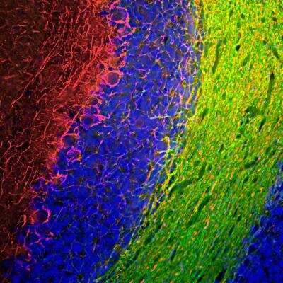 Immunohistochemistry Free-Floating: NF-M Antibody [NB300-222]