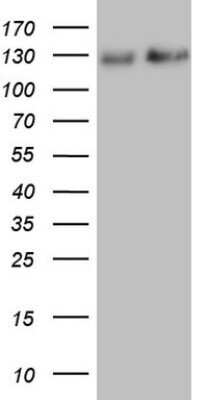 Western Blot: NF-M Antibody (OTI2G3)Azide and BSA Free [NBP2-72977]
