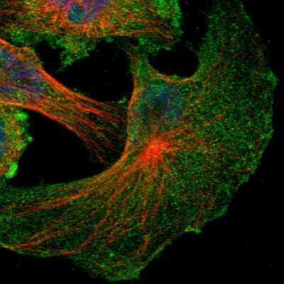 Immunocytochemistry/ Immunofluorescence: NF2/Merlin Antibody [NBP1-87757]