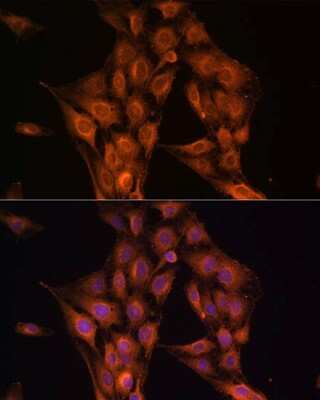 Immunocytochemistry/ Immunofluorescence: NF2/Merlin Antibody - BSA Free [NBP3-03740]