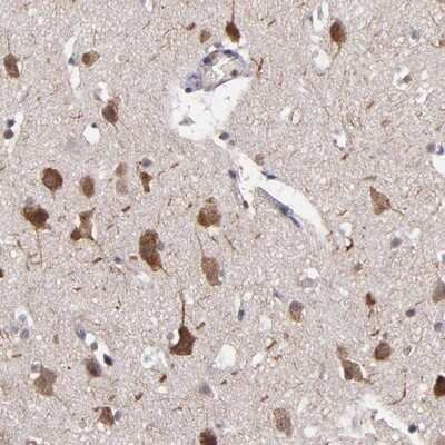 Immunohistochemistry-Paraffin: NF2/Merlin Antibody [NBP1-87757]