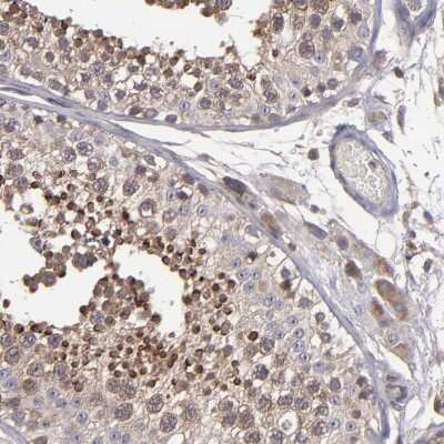 Immunohistochemistry-Paraffin: NF2/Merlin Antibody [NBP1-87757]
