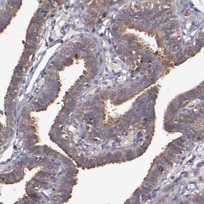 Immunohistochemistry-Paraffin: NF2/Merlin Antibody [NBP1-87757]
