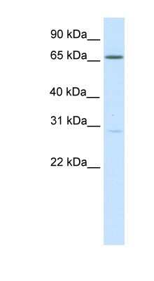 Western Blot: NFAT5 Antibody [NBP1-80257]