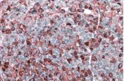 Immunohistochemistry-Paraffin: NFATC2/NFAT1 Antibody [NBP1-51970]