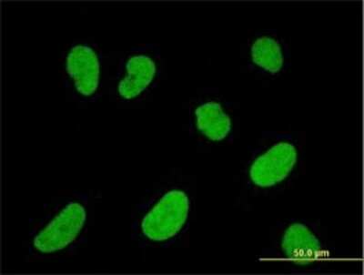 Immunocytochemistry/ Immunofluorescence: NFATC2IP Antibody (2D7-A10) [H00084901-M01]