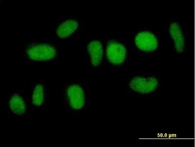 Immunocytochemistry/ Immunofluorescence: NFATC2IP Antibody [H00084901-B01P]