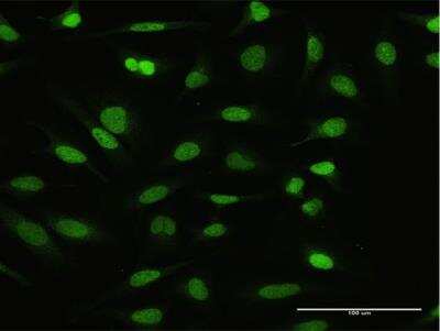 Immunocytochemistry/ Immunofluorescence: NFATC2IP Antibody [H00084901-D01P]