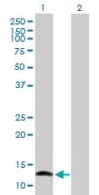 Western Blot: NFATC2IP Antibody [H00084901-B01P]