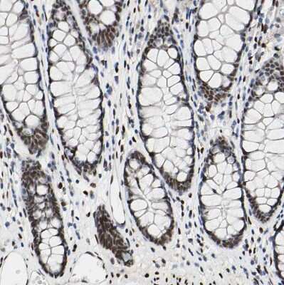 Immunohistochemistry-Paraffin: NFIA Antibody [NBP1-81406]