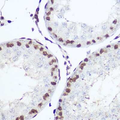 Immunohistochemistry-Paraffin: NFIA Antibody - BSA Free [NBP2-94656]