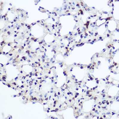 Immunohistochemistry-Paraffin: NFIA Antibody - BSA Free [NBP2-94656]