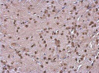 Immunohistochemistry-Paraffin: NFIB Antibody [NBP2-19526]