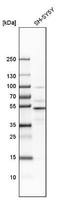 Western Blot: NFIB Antibody [NBP1-81000]