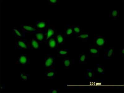 Immunocytochemistry/ Immunofluorescence: NFIX Antibody [H00004784-B01P]