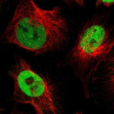 Immunocytochemistry/ Immunofluorescence: NFIX Antibody [NBP2-58904]