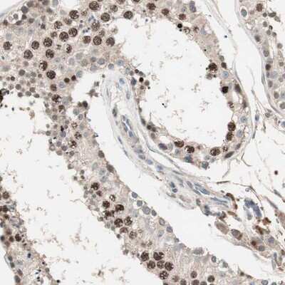 Immunohistochemistry-Paraffin: NFRKB Antibody [NBP1-85096]