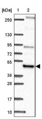 Western Blot: NFS1 Antibody [NBP2-38737]