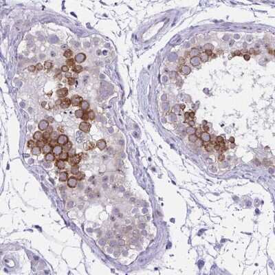 Immunohistochemistry-Paraffin: NFXL1 Antibody [NBP2-31746]