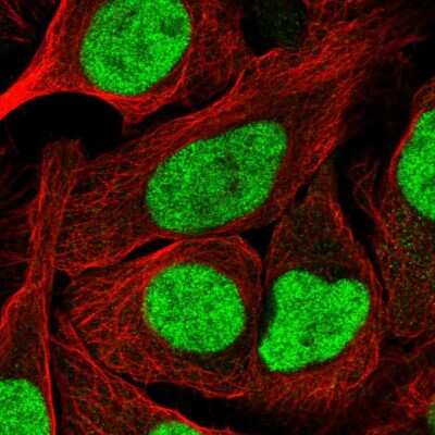 Immunocytochemistry/ Immunofluorescence: NFYA Antibody [NBP2-48977]