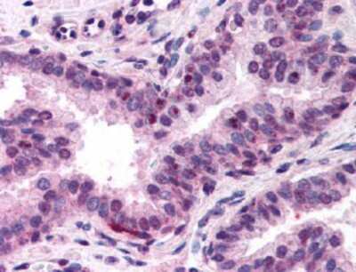 Immunohistochemistry: NFYA Antibody [NB600-481]