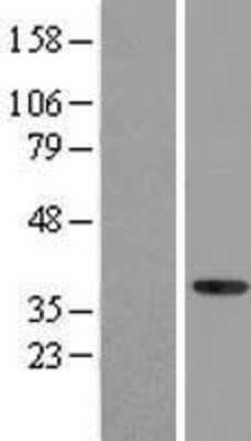 Western Blot: NFYA Overexpression Lysate [NBL1-13628]