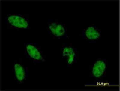 Immunocytochemistry/ Immunofluorescence: NFYB Antibody (6E4) [H00004801-M02]