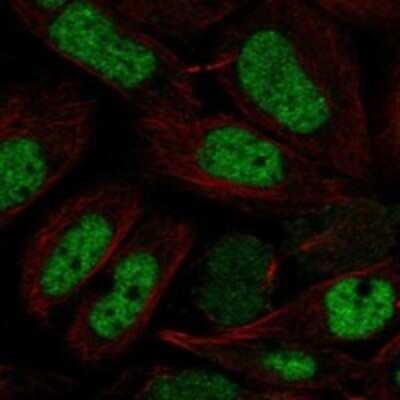 Immunocytochemistry/ Immunofluorescence: NFYB Antibody [NBP3-17745]
