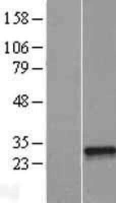 Western Blot: NFYB Overexpression Lysate [NBL1-13629]
