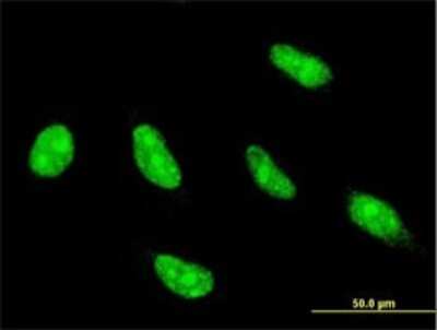 Immunocytochemistry/ Immunofluorescence: NFYC Antibody (1D3) [H00004802-M01]