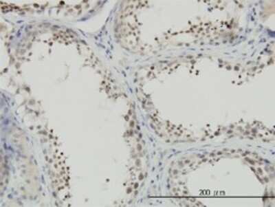 Immunohistochemistry-Paraffin: NFYC Antibody (1D3) [H00004802-M01]