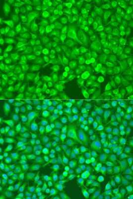 Immunocytochemistry/ Immunofluorescence: NFkB p100/p52 Antibody - BSA Free [NBP2-95200]