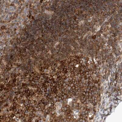Immunohistochemistry-Paraffin: NFkB p100/p52 Antibody [NBP1-87759]