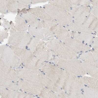 Immunohistochemistry-Paraffin: NFkB p100/p52 Antibody [NBP1-87759]