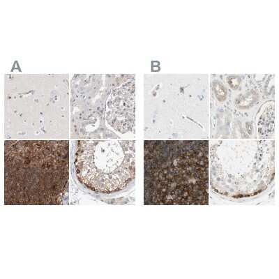 Immunohistochemistry-Paraffin: NFkB p100/p52 Antibody [NBP1-87759]